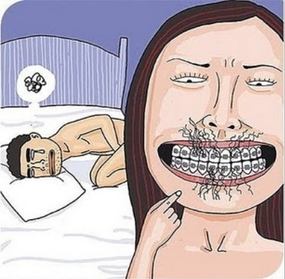 Miért ne szexelj fogszabályzós csajjal ?! 