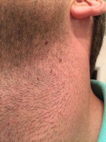 Borosta - gabonakör edisön