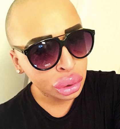 Újabb csalánszopó versenyt rendeztek