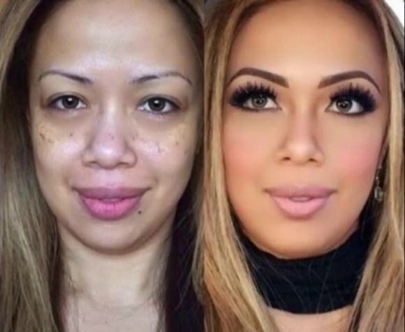 Mi a születésszabályozás legegyszerűbb módja?