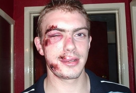 Ha anyósodnak bókolsz, sose dicsérd a bajszát!