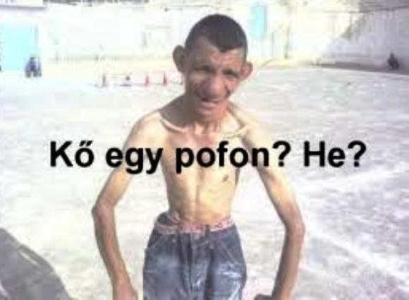 Béla kicombosodott, mint a mocsári szúnyog