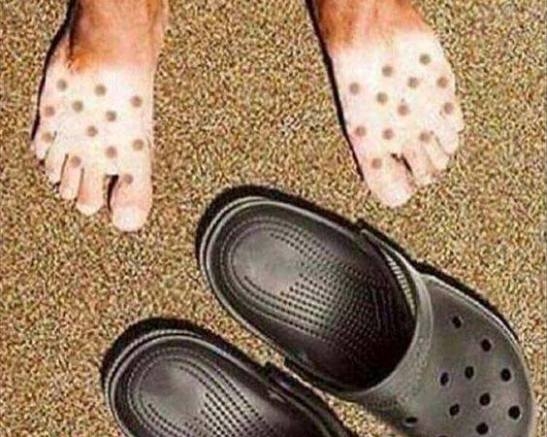 Óvatosan az első napozással