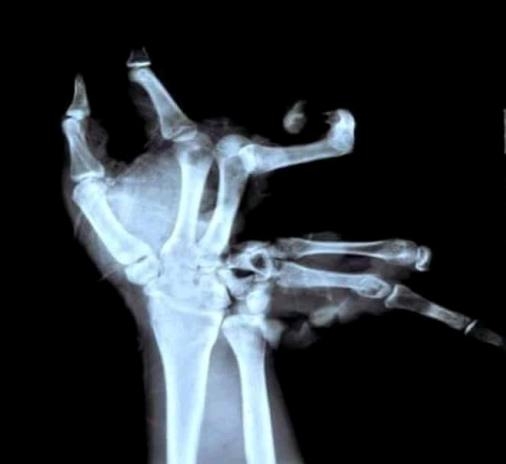 Amikor elsőnek fogsz kezet, a csajod apjával