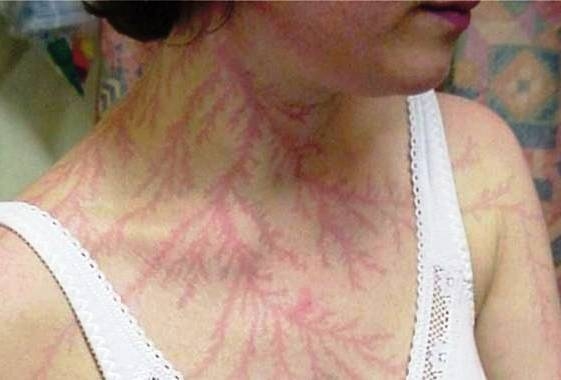 Belecsapott a villám...