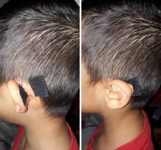 Egy érdekes megoldás