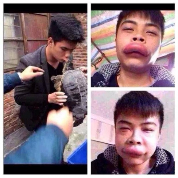 Egyes csajok egy csomó pénzt költenek, hogy ilyen legyen az ajkuk