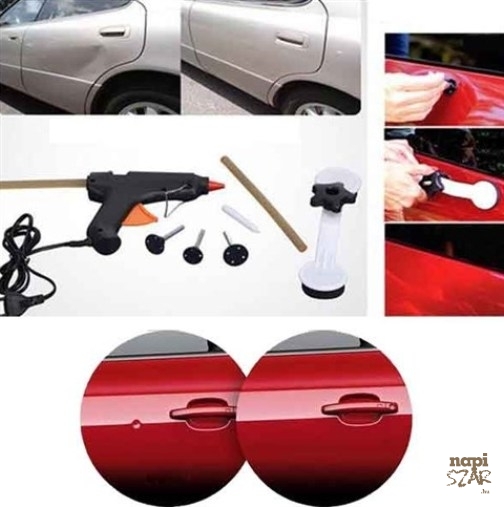 Horpadásjavító készlet autósoknak (x)