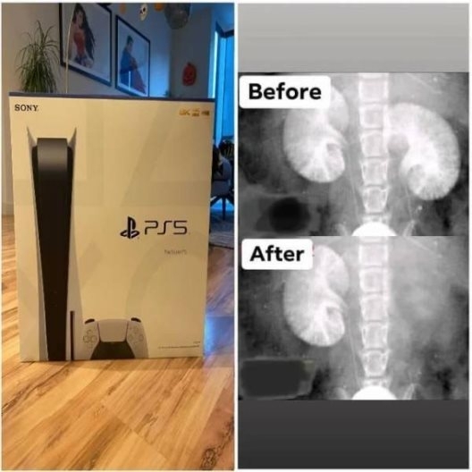 PS5 - Nagy árat fizetett érte, de végre megvan