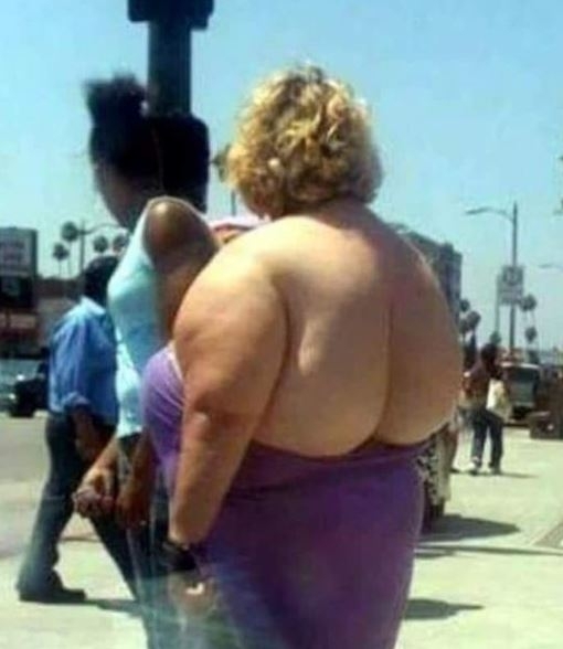 Felvarratta a seggét a hátára