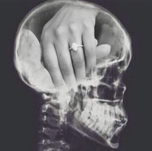 Egy 30 éves női koponya tartalma