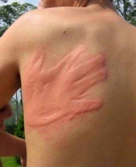 Egy fájdalmas nyári emlék