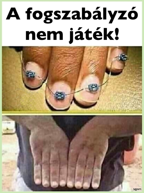 Tegyük helyre a dolgokat