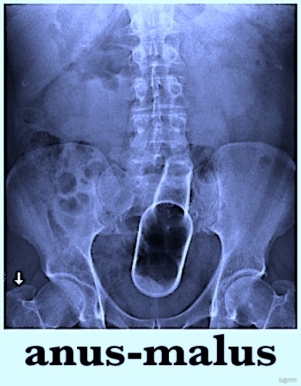 Ha beléd mennek hátulról, jöhet a biztosító