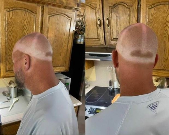 Óvatosan a napozással!