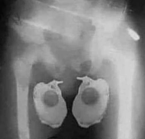 A több napja tartó forróság első áldozatai