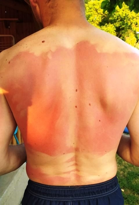 Ezerrel dübörög a nyár