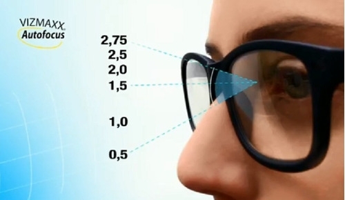 A közeli éleslátás nem luxus többé (x)