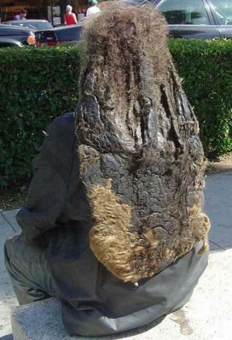 Higiénia - Szeretem