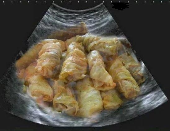 Karácsonyi ultrahang