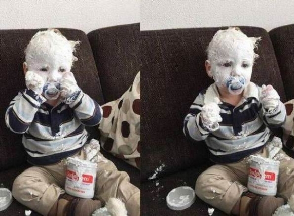 Sudocrem - Egyetlen kenőcs 6 bőrproblémára