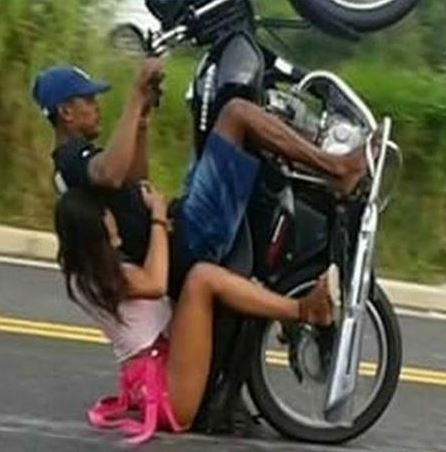 Végleges szőrtelenítés