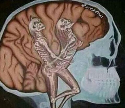 Hősünknek ma megröntgenezték az agyát