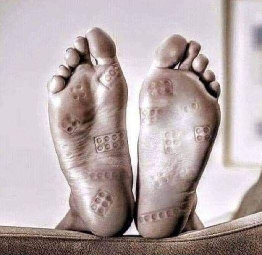 Kisgyermekes szülők akupunktúrás kezelése