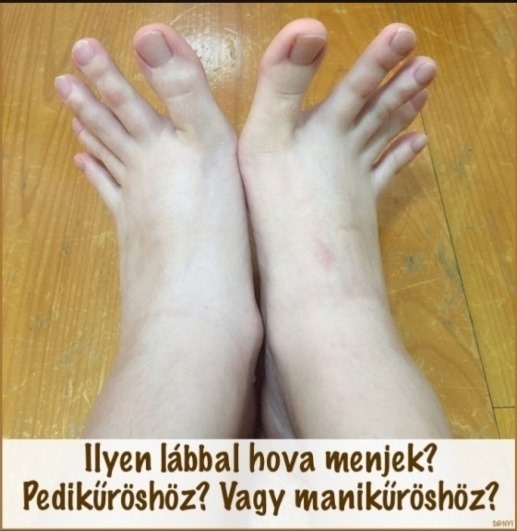 Befutott a nap kérdése