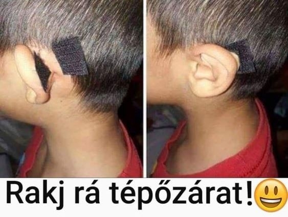 Elálló a füled?!