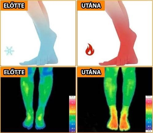 Turmalinos hőzokni - Egy szuper termék a hideg lábakra (x)